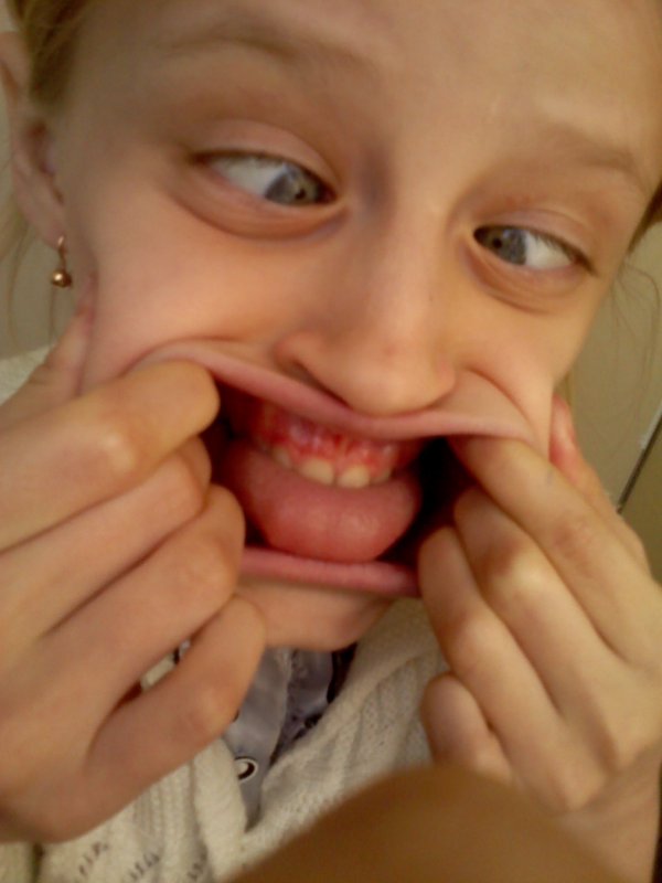 Черепок ВЫГЛЯНЕТ!